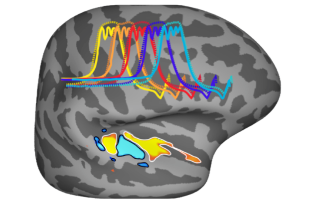 Gehirnaktivität bei musikalischer Tonhöhenverarbeitung Illustration eines Gehirnscans mit farbigen Linien zur Darstellung der Reaktion auf musikalische Tonhöhen